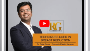 Breast Reduction Surgery Procedure & Postoperative Care - Dr. Rajat Gupta